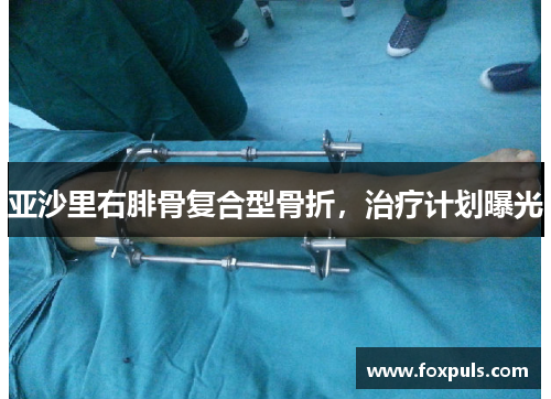 亚沙里右腓骨复合型骨折，治疗计划曝光